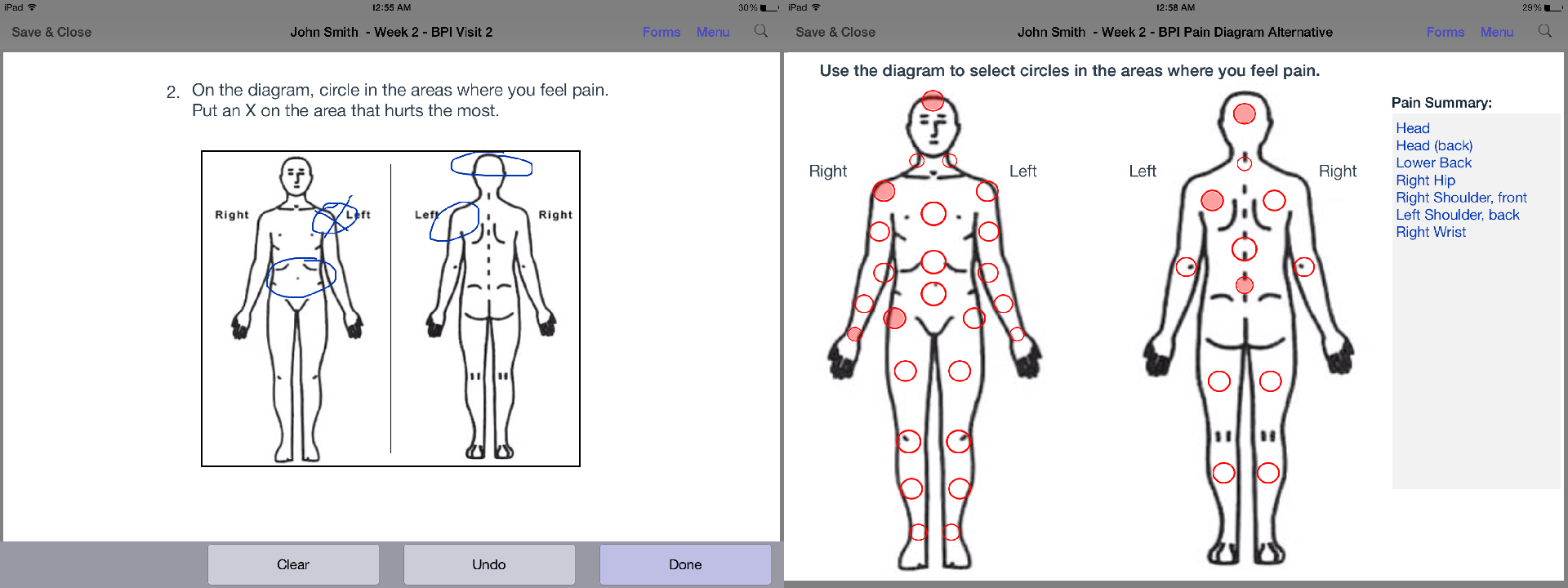 Body Diagram