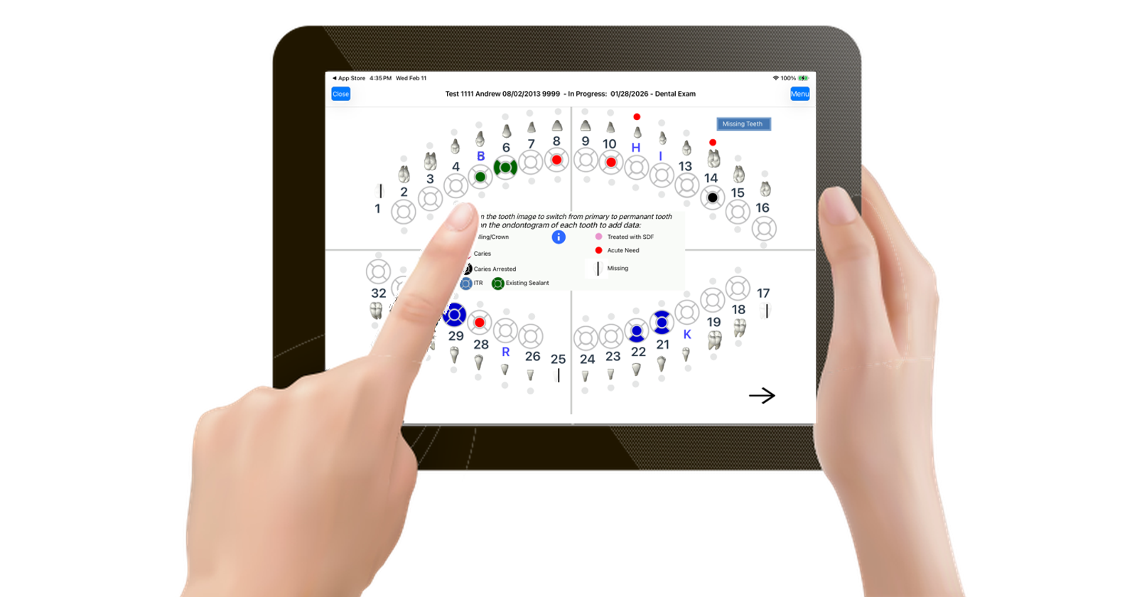 NEForm Tablet App - Feature 3